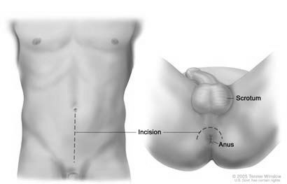 Prescribed steroids for rash